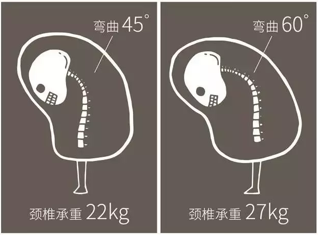 现代人是如何搞垮自己的脊椎的？