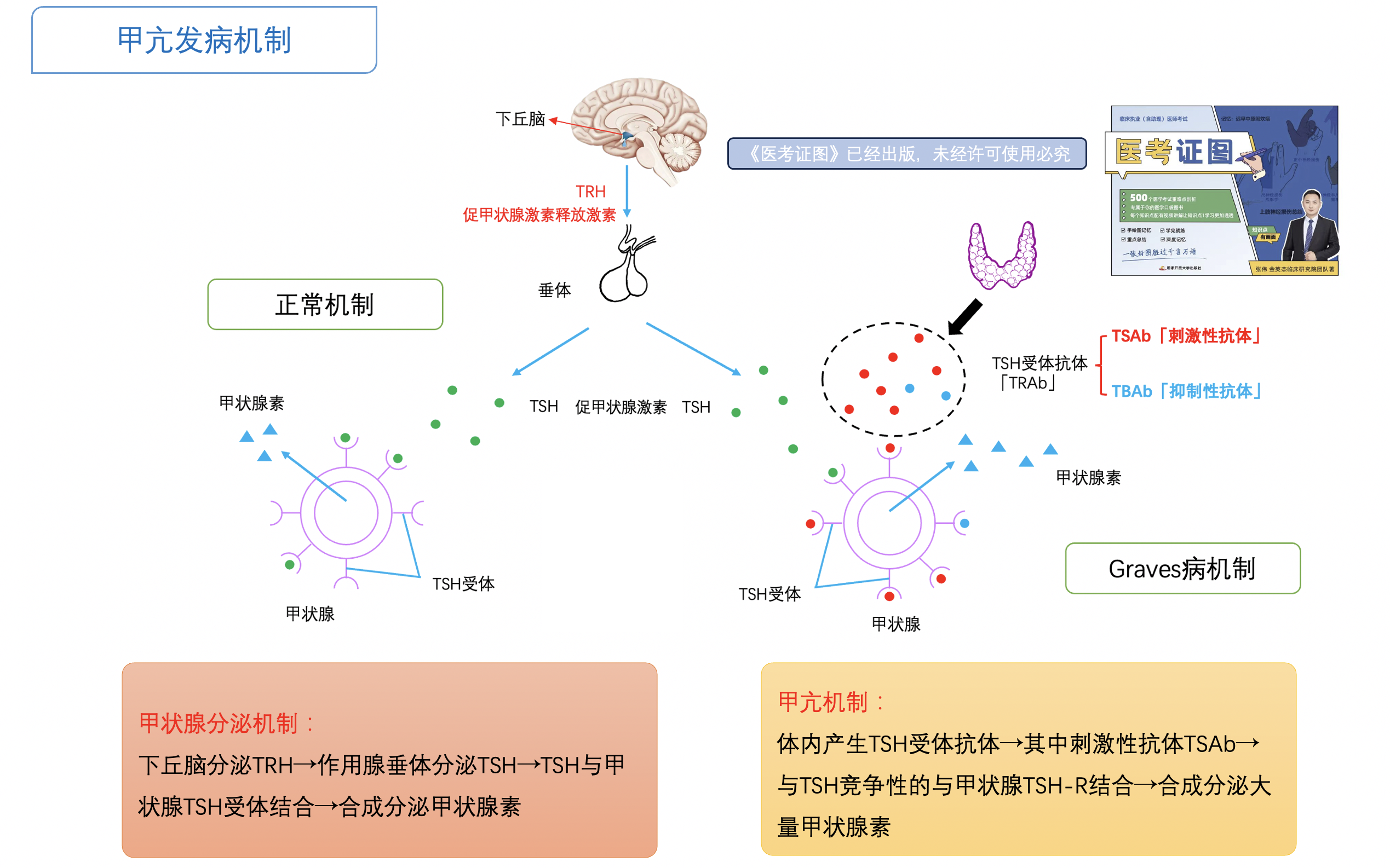 甲亢发病机制.png